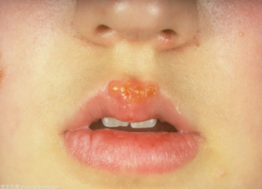103fd881dcb7d0353dd6b828f576e17f.png